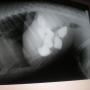 cuerpos extraños abdómen