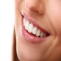 Blanqueamiento Dental