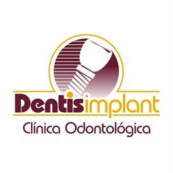 Dentis Implant Clinica Odontologica