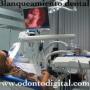 Blanqueamiento dental