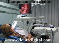 Blanqueamiento dental