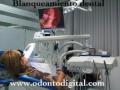Blanqueamiento dental