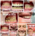 English speaking dentist in Miraflores - Lima