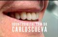 PROTESIS DENTAL