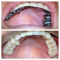 REHABILITACION-ORAL