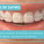 Brackets de zafiro