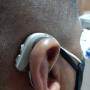 Audifono Medicado Ultrapotente