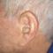 Audifono-CIC-INVISIBLE-3