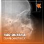 Radiografía