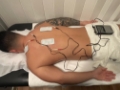 Electroterapia